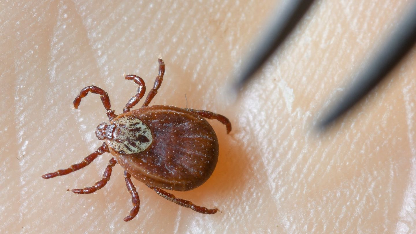 Zecken: Borreliose-Fälle nach Zecken-Stichen nehmen zu