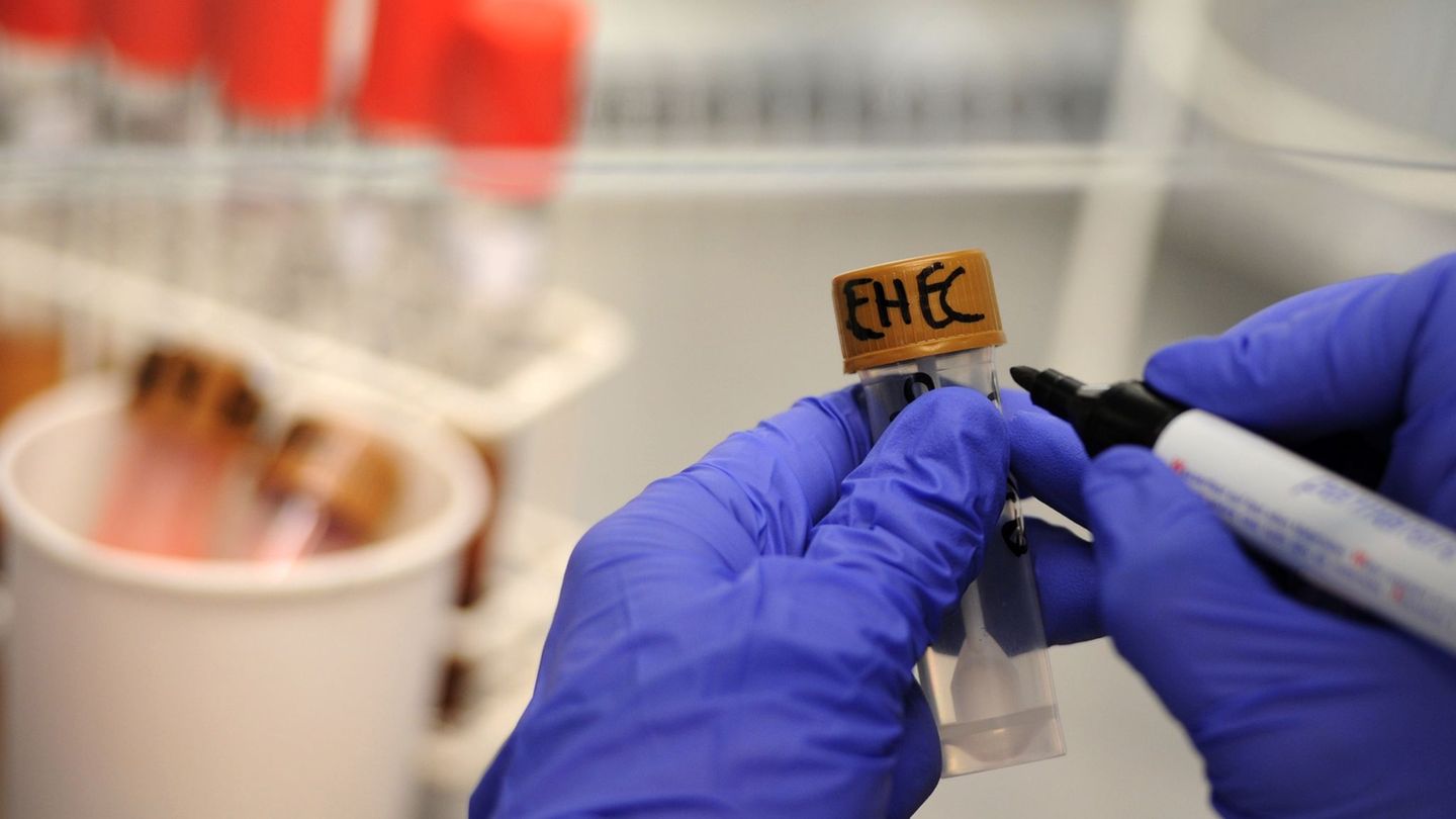 Ehec-Ausbruch in MV: Ehec-Ausbruch – Gesundheitsministerin: Hygiene beugt vor